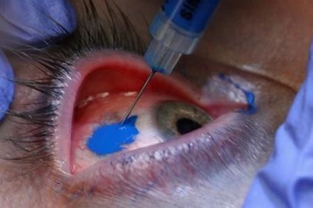 eyeball tattoo pictures
