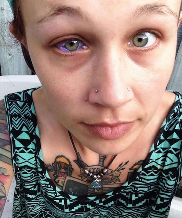 10 Extreme Eyeball Tattoos That Look Incredibly Painful