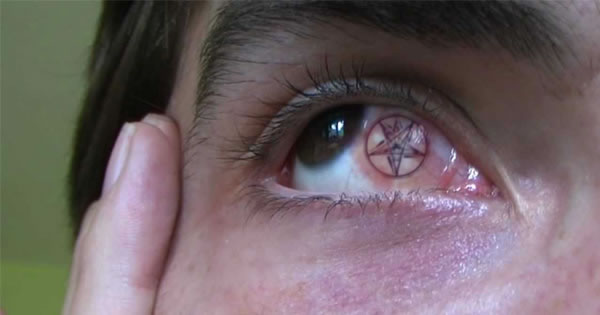 Model Nearly Loses Eye After Sclera Tattoo Why She Did It  Time