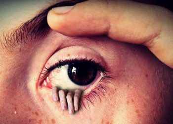 Contours Rx Review: Does This Eyelid Lifter Really Work?