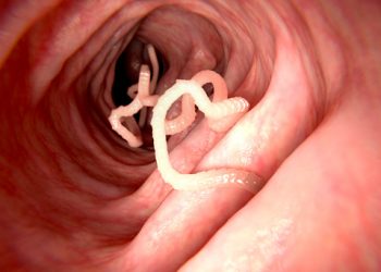 Dangerous and Painful Fashion Trends “From The Past”: Part One