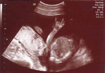 funny baby ultrasound photosphoto