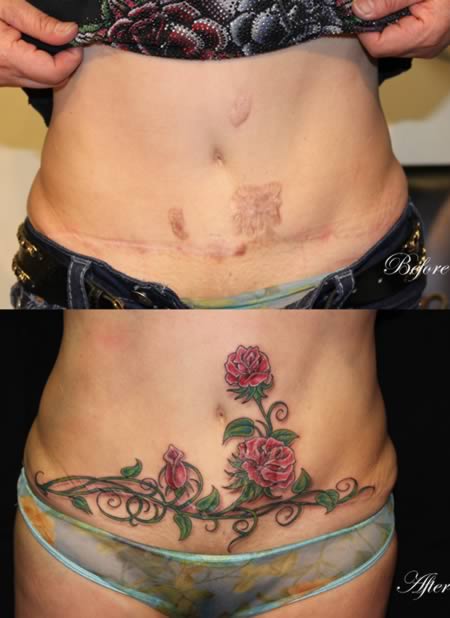 Tattoo Over a Scar What to Know Pain Level and More