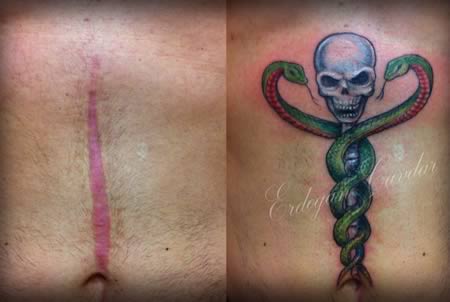 12 Coolest Tattoos Covering Scars - tattoos over scars, tattoos to cover  scars - Oddee