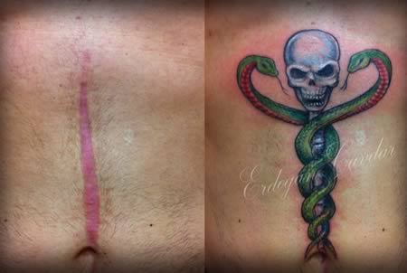 12 Coolest Tattoos Covering Scars - tattoos over scars, tattoos to cover scars - Oddee 12 Coolest Tattoos Covering Scars - tattoos over scars, tattoos to cover scars - Oddee