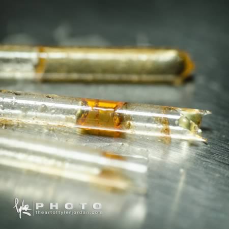 10 Craziest Foreign Objects Removed from Urethras - Oddee 10 Craziest Foreign Objects Removed from Urethras - Oddee