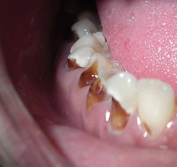 World's sales ugliest teeth