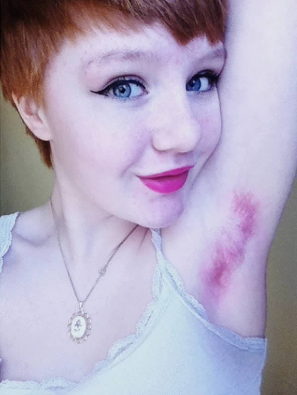 New Beauty Trend: 12 Craziest Photos of Dyed Armpit Hair - Oddee