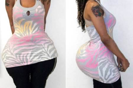 8 Most Disturbing Body Parts after Plastic Surgery - bad plastic